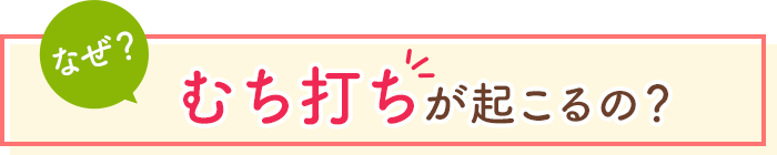 なぜ、むち打ちが起こるの？